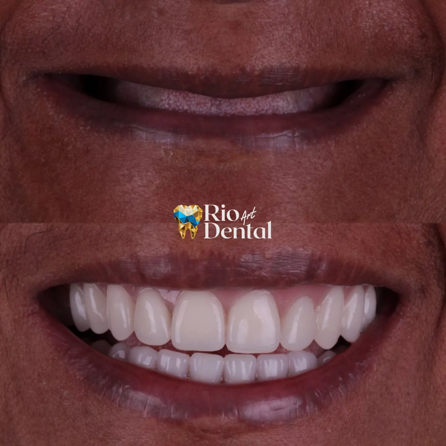 Dentista em Orlando - Implante Dentário em Orlando - Rio Dental Art
