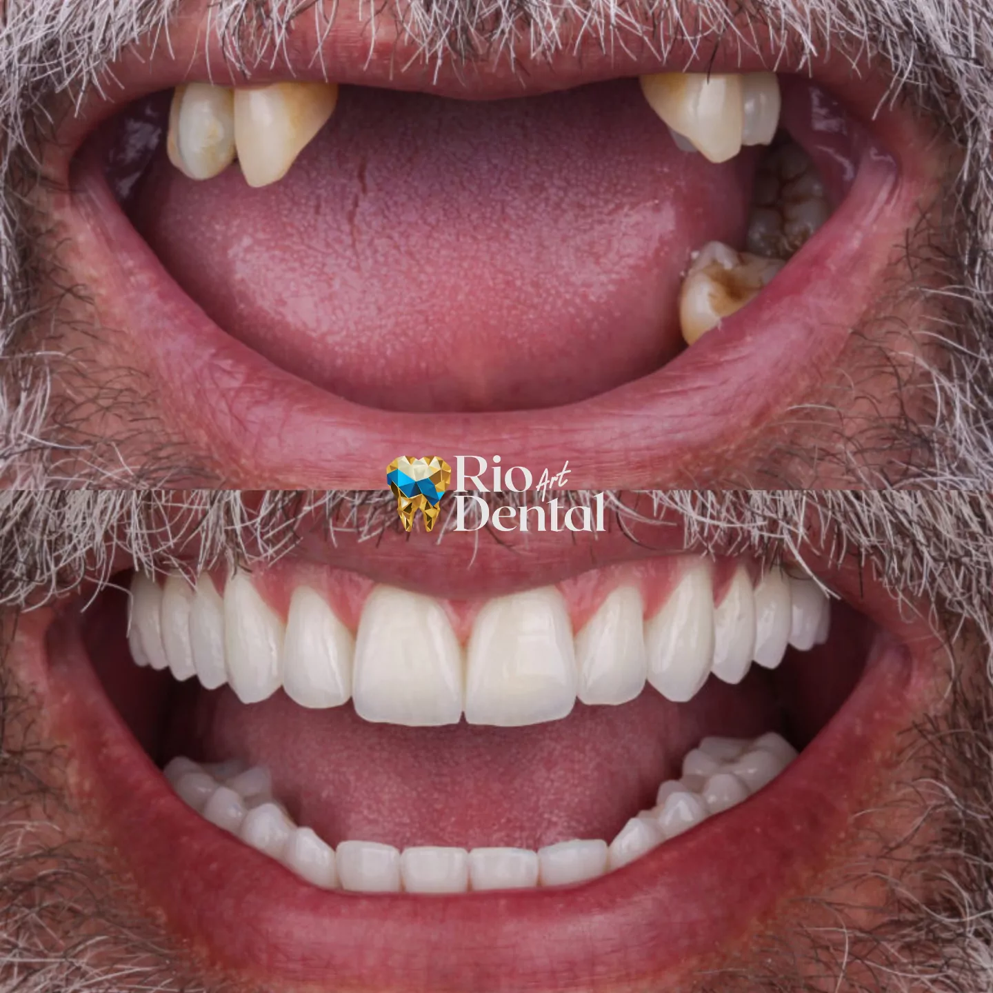 Dentista em Orlando - Implante Dentário em Orlando - Rio Dental Art